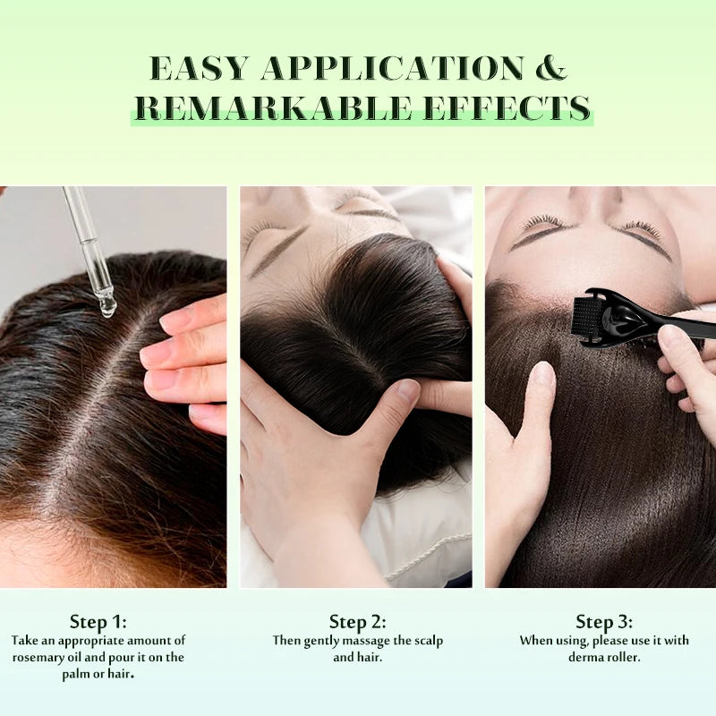 Sevich Rosemary Hair Growth Oil