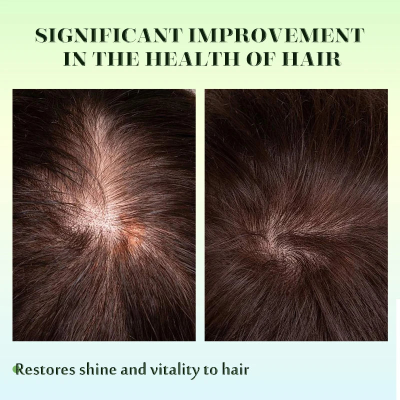 Sevich Rosemary Hair Growth Oil